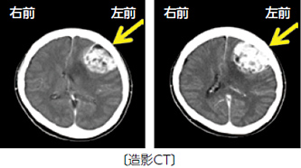 見出し