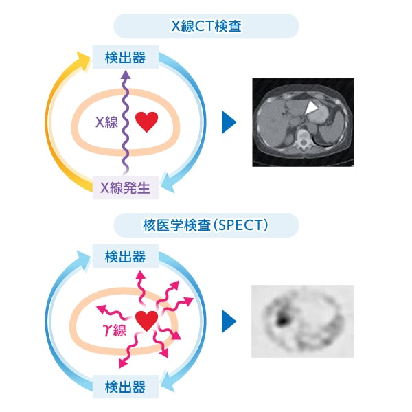 PET/CT検査、核医学検査イメージ図