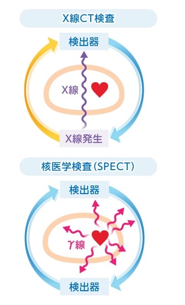 PET/CT検査、核医学検査イメージ図