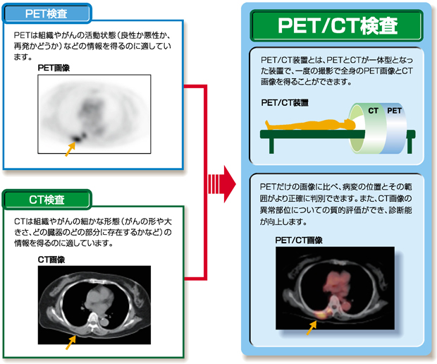 PET/CT検査図