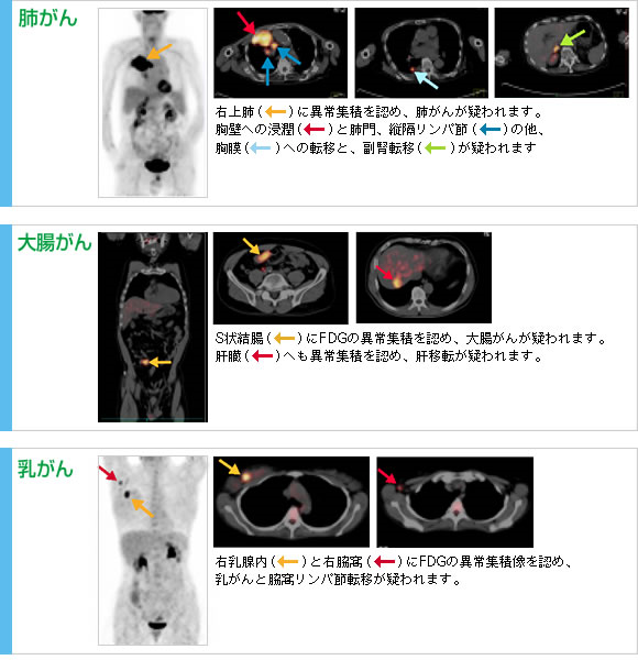 【サイズ:外径約：34*33*35cm（ドーム型）_色:チエックグリーン】Pet