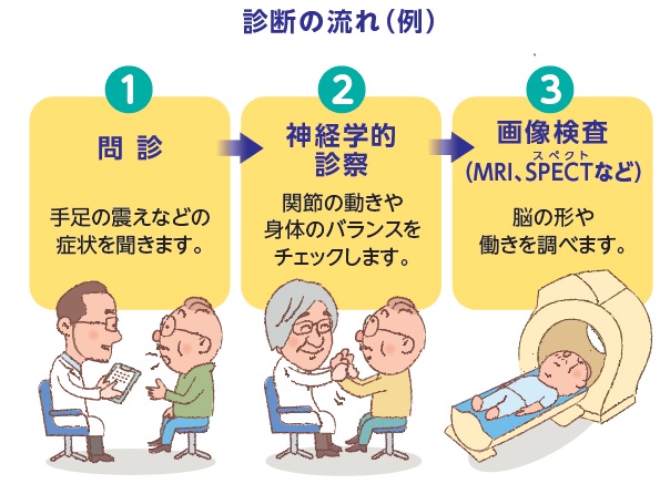 新しいSPECT検査の画像　MRI検査の画像　順天堂大学医学部附属順天堂医院　提供