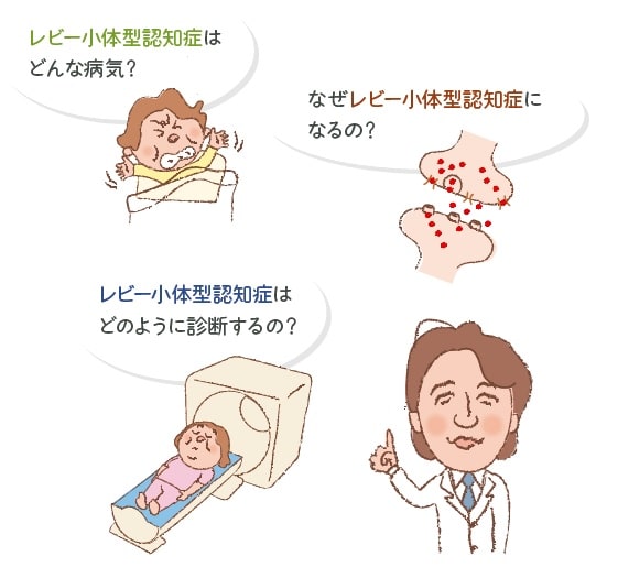 小 特徴 症 体型 レビー 認知