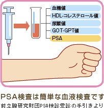 PSA検査は簡単な血液検査です（前立腺研究財団PSA検診受診の手引きより）