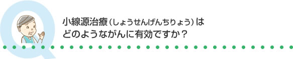 小線源治療（しょうせんげんちりょう）はどのようながんに有効ですか？