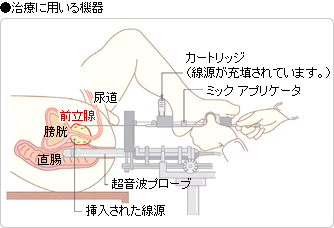 ●治療に用いる機器