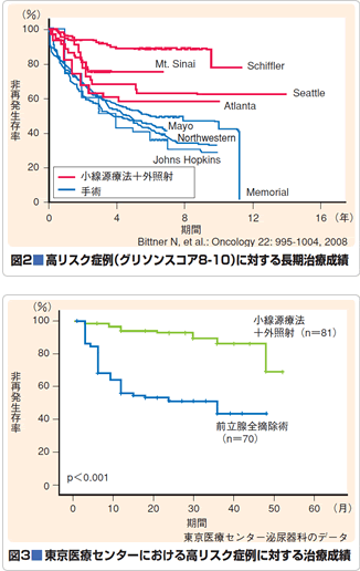 図2　高リスク症例（グリソンスコア8-10）に対する長期治療成績<br />
図3　東京医療センターにおける高リスク症例に対する治療成績