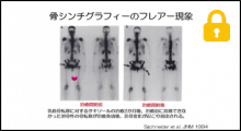 乳癌骨転移診断 (後半)