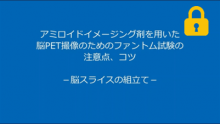 脳スライスの組立て サムネイル