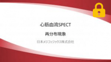 再分布現象  サムネイル