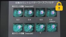 前処理フィルタ,心筋軸設定　サムネイル