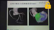 症例の解説(右冠動脈病変)　サムネイル