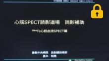 負荷心筋血流SPECT検査のポイント　サムネイル