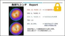 症例1 50歳代男性,非心臓手術術前検査目的,負荷Tlシンチ