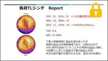 症例2 50歳代男性,FFR defer後,負荷Tlシンチ