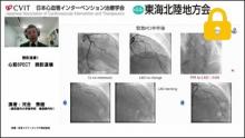 症例2　60代男性 急性胸痛 サムネイル