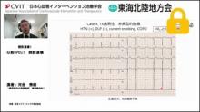 症例4　70代男性 非典型的胸痛 サムネイル