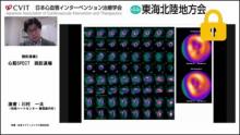 症例1　70代男性　労作時胸痛(非典型的) サムネイル