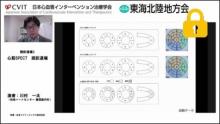 症例2　薬物負荷シンチ画像から考察する サムネイル