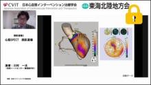 症例3　60代男性 無症状(糖尿病、高血圧、脂質異常症あり）サムネイル