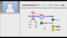 心筋SPECT：負荷法　サムネイル