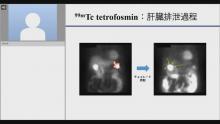 心筋SPECT画像の基礎 サムネイル