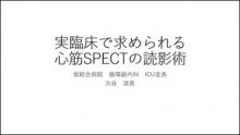 おさらい(冠動脈灌流域の推定、アーチファクト、読影手順) サムネイル