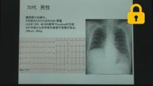 症例3 70歳代男性 主訴労作時の胸部不快感 既往歴 糖尿病,CAG サムネイル