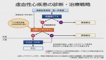 治療戦略における心筋シンチとFFRの役割 説明写真