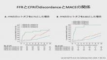 虚血評価の未来1　座談会写真