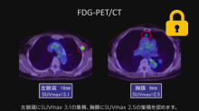 Case7 乳癌の再発診断 スライド