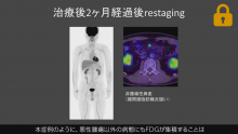 Case5 治療前後の評価