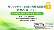 転移性ホルモン感受性前立腺癌：mHSPC編 サムネイル