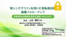 非転移性去勢抵抗性前立腺癌：M0CRPC編 サムネイル