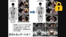 臨床医に期待される PET/CT レポートとは サムネイル