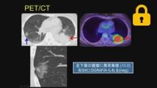 原発部位別病期診断の実際② サムネイル