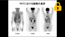 機器の進歩、PETの強み サムネイル