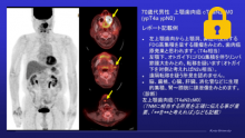読影レポートの実例紹介 サムネイル