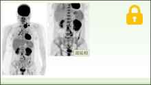 一枚のMIP像から病態を読み解く サムネイル