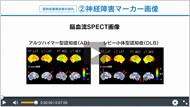神経障害マーカー画像検査（MRI/脳血流SPECT）