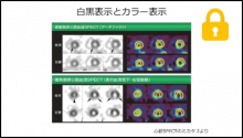 SPECT画像を見よう１ (プラナー、ブルズアイの見方) 読影道場 高島先生2