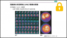 SPECT画像を見よう２ (冠動脈支配領域と虚血部位) 読影道場高島先生3