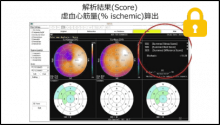 SPECT画像を見よう３ (スコアリング)　読影道場 高島先生4