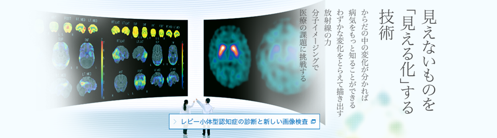 見えないものを「見える化」する技術 からだの中の変化が分かれば病気をもっと知ることができる わずかな変化をとらえて描き出す放射線の力 分子イメージングで医療の課題に挑戦する レビー小体型認知症の診断と新しい画像検査