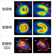 負荷時 安静時 安静時QGS